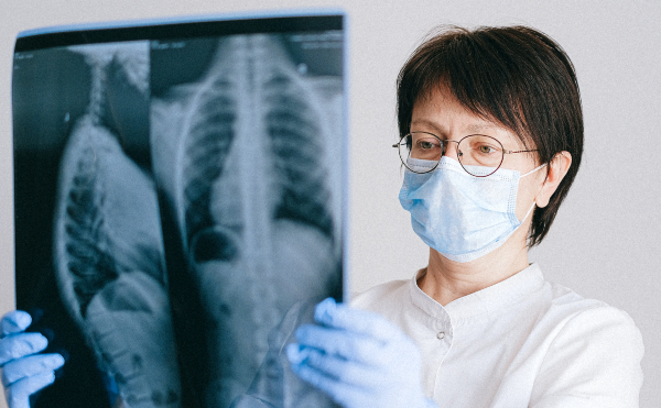 肺部檢查發現「肺結節」怎麼辦？亞洲肺癌手術權威陳晉興醫師告訴你《肺癌的預防與治療》！