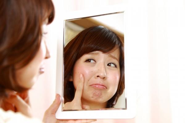 如何分辨曬斑、肝斑、老人斑？這樣預防，避免成為「郭台銘臉」