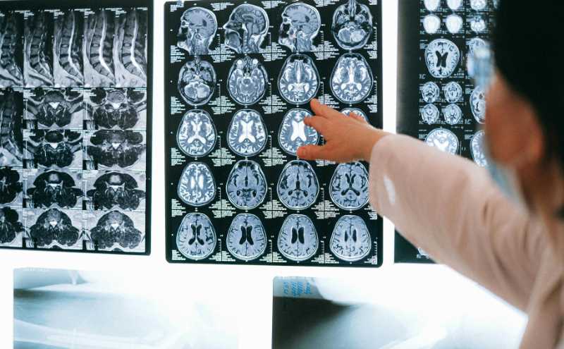 沒有記憶的人依然可以很聰明？一場意外手術揭開大腦神經科學之謎｜《父親的腦》