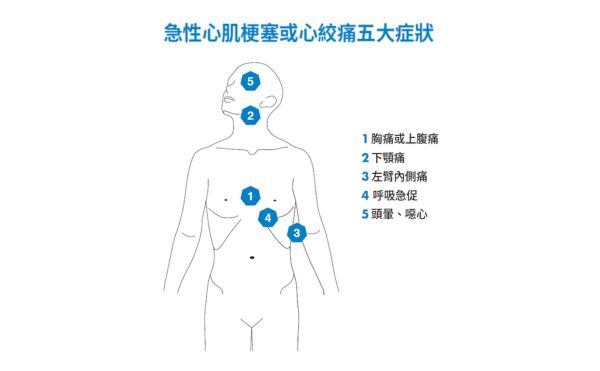 心肌梗塞前兆有哪些？學會護心8大心法，擺脫心血管疾病威脅！｜《江晨恩醫師心血管診療室》