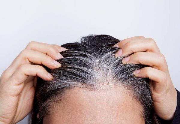 白髮為何生成？醫師公開3大白髮元凶，你犯了幾個