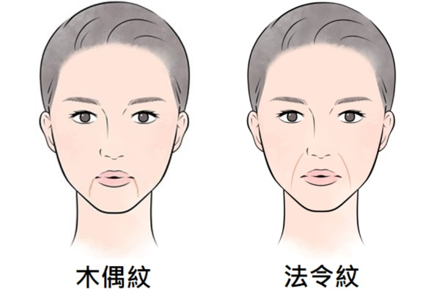 臉部出現木偶紋、法令紋怎麼辦？5個日常保養預防紋路形成與加深