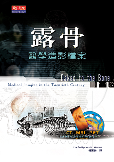 露骨：醫學造影檔案