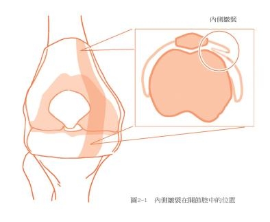 【愛健康】避免50後常見的退化性關節炎！應該這樣使用膝蓋_img_1
