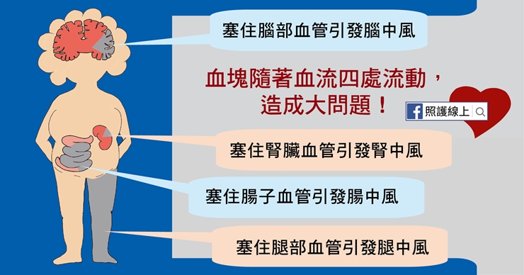 【照護線上】如何避免中風？檢查自己是否有「心房顫動」_img_6