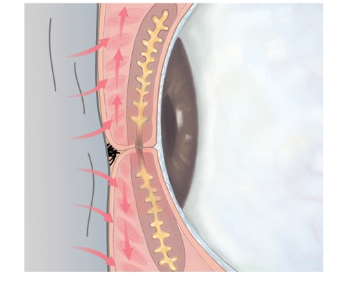 眼科醫師李文浩：減緩乾眼症狀，這樣熱敷才正確_img_3