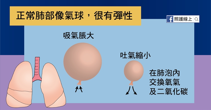 【照護線上】呼吸不順、容易累？50後小心「肺纖維化」上身！_img_1