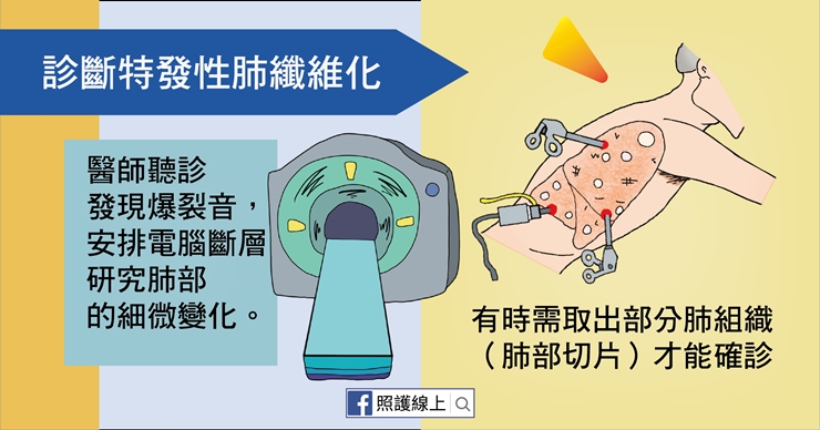 【照護線上】呼吸不順、容易累？50後小心「肺纖維化」上身！_img_5