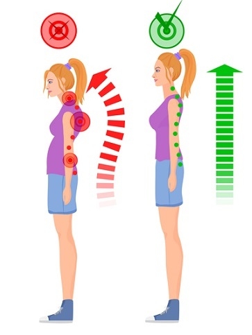 想看起來年輕？醫師：讓「視覺減齡」的走、站與提包包法_img_1