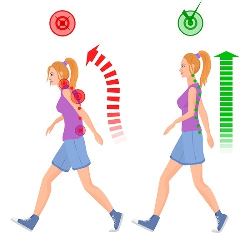 想看起來年輕？醫師：讓「視覺減齡」的走、站與提包包法_img_2