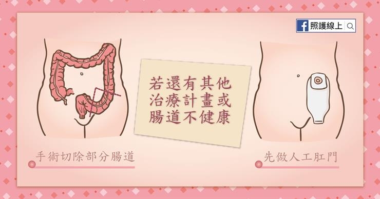 照護線上｜50歲後最易得大腸癌！檢查8件事，提早預防保命_img_6