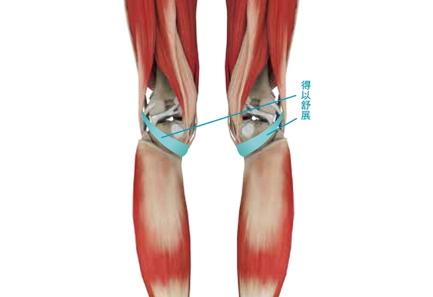 改善膝蓋痛與腰痛!專家:每日刺激一下「膝窩」,減輕膝蓋與腰的負擔_img_3
