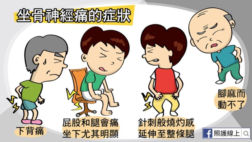 照護線上│50後易坐骨神經痛！屁股痛、腳麻、腿刺痛，在家做7件事預防與改善_img_2