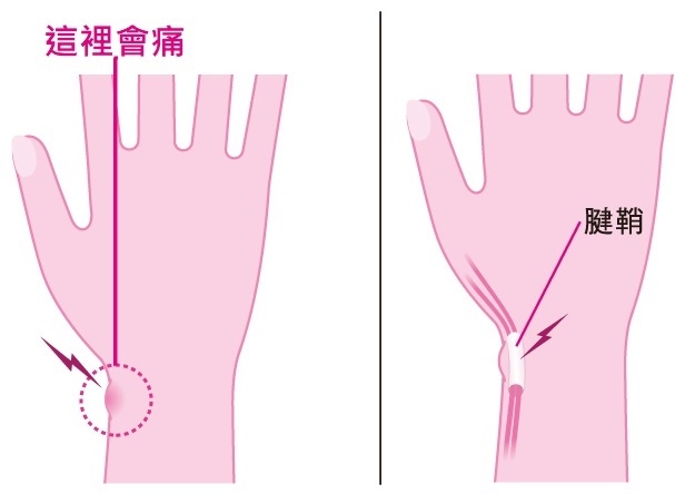 (圖片來源:日経ARIA)