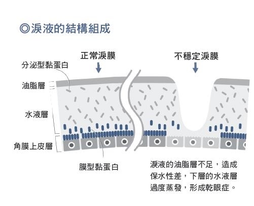 50後眼睛困擾一次解答!醫師:每天多做3件事,改善眼力、乾眼症、眼皮下垂_img_2