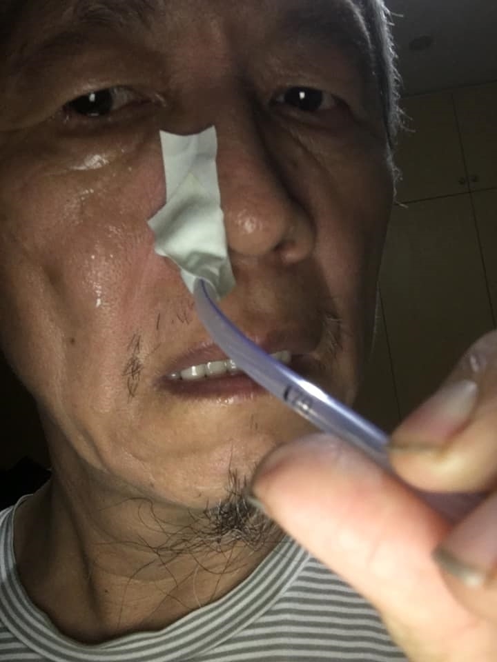 居家醫療醫師陳乾原，自插鼻胃管實驗後的省思：老後不想插管，現在該做哪些準備？_img_1