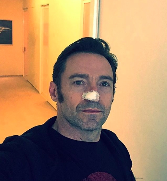 40歲後手腳長痣,可能是惡性黑色素瘤!皮膚科醫師:5原則分辨好痣和兇痣_img_1