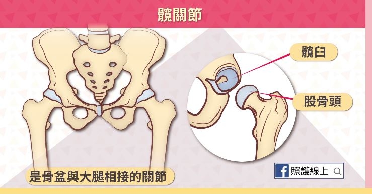 照護線上|大腿屁股痛、走路僵硬?小心髖部退化性關節炎!9動作日常保養髖關節_img_1