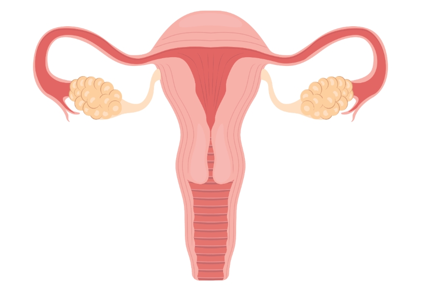 更年期後的婦科3大癌：子宮頸癌、卵巢癌、子宮內膜癌，如何及早發現和預防？_img_1