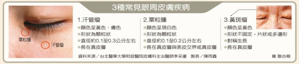 眼周附近有脂肪粒是疾病嗎?可以醫美或雷射嗎 ? 醫師解析常見3種皮膚瘤處理_img_3
