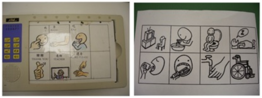 布魯斯威利因失語症引退!失語症是什麼?說話流暢、但不知自己在說啥也是徵兆 _img_1