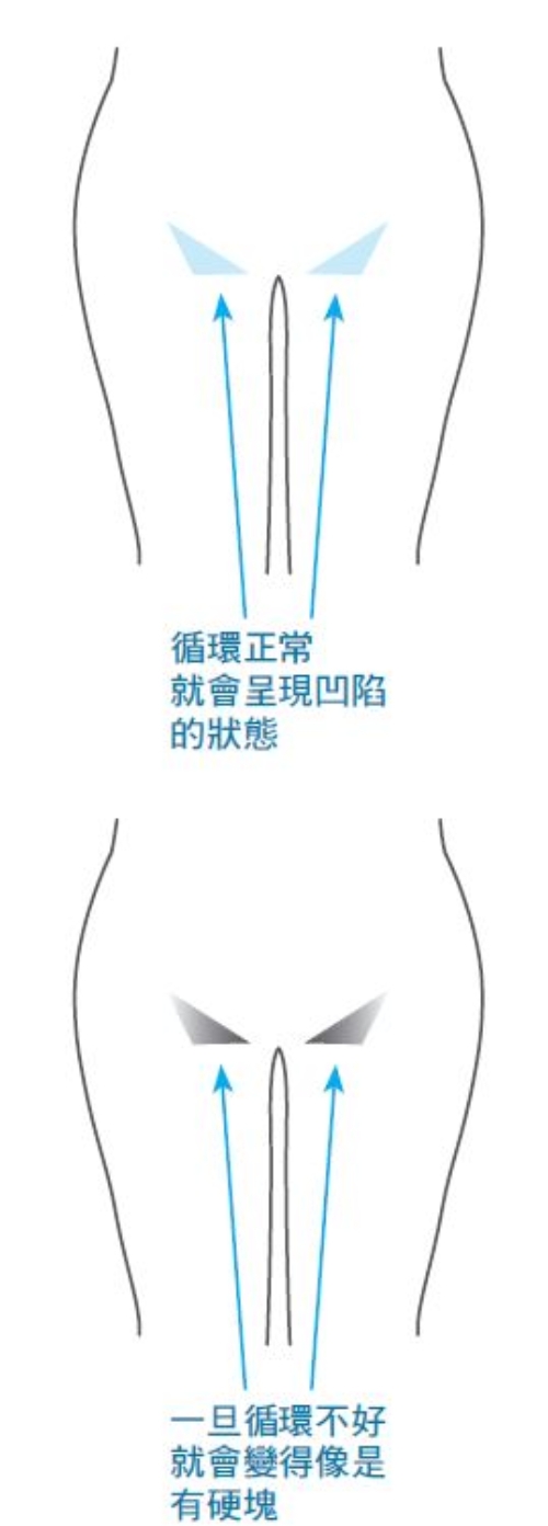 腳水腫、手臂粗，恐淋巴阻塞！每天這樣動手動腳，淋巴排毒要疏通重點2部位_img_4