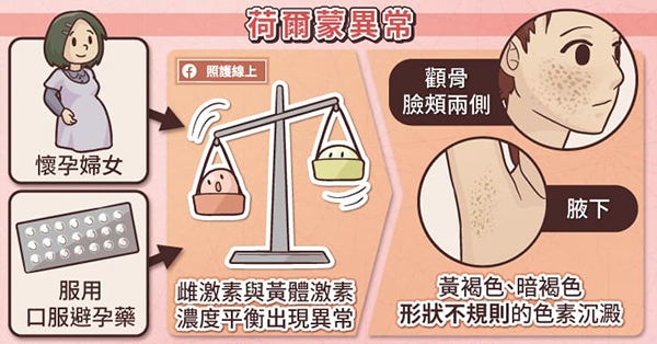 照護線上｜腋下變黑，可能是罹病徵兆！單純發炎後色素沉澱和黑色棘皮症，差別在哪？_img_2