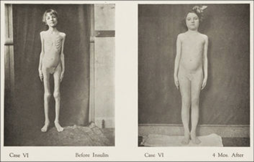 中年減重,不只靠少吃多動!蕭捷健醫師:做到3件事重整胰島素,轉換成易瘦體質_img_1