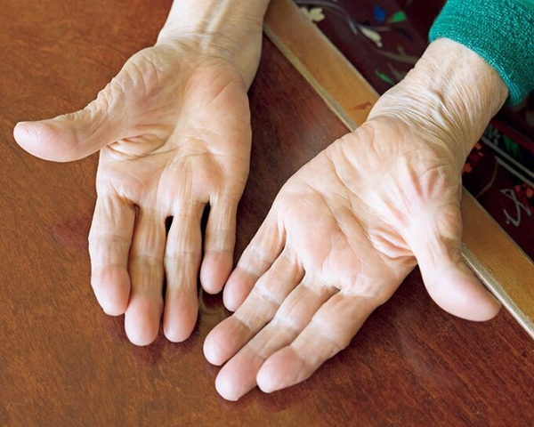 105歲還能挺直腰、當東奧聖火傳遞手!箱石阿嬤的元氣秘訣:日行千步30年、自己種新鮮蔬果兼練身體_img_3