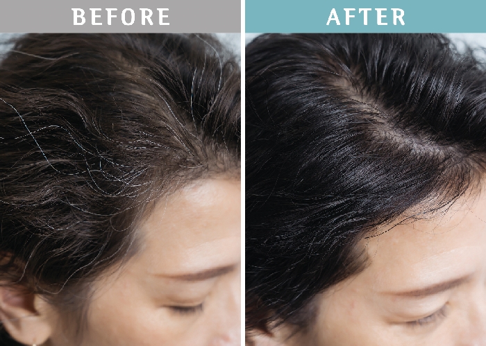 告別白髮讓髮色迎向青春，設計師與皮膚科醫師都強力推薦的日本天然來源健康染髮劑_img_4