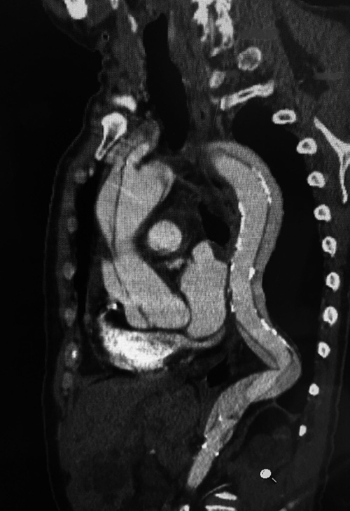 （圖片來源：《俠醫楊智鈞的50道心臟密碼》）
