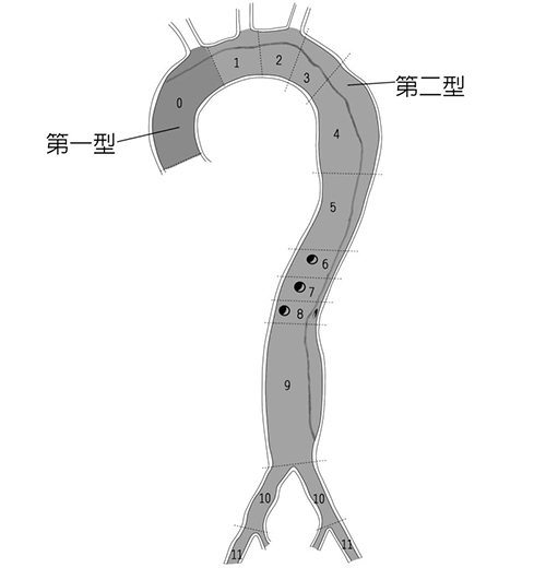 （圖片來源：《俠醫楊智鈞的50道心臟密碼》）