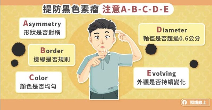 照護線上｜異常黑斑、指甲有黑線，恐是惡性黑色素瘤！ 死亡率最高皮膚癌有哪些症狀？_img_3