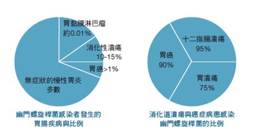 根除幽門螺旋桿菌可降低胃癌風險!成因、傳染途徑、如何治療?_img_2
