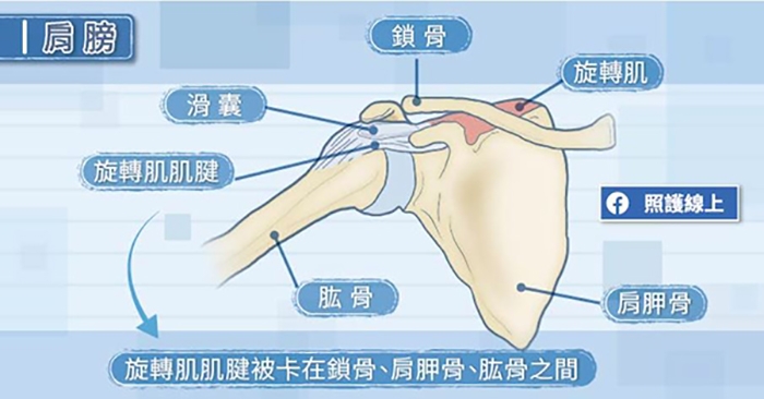 （圖片來源：照護線上）