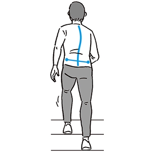 下樓梯腳痛、膝蓋痛，怎麼辦？動作專家：前腳著地位置很關鍵_img_1