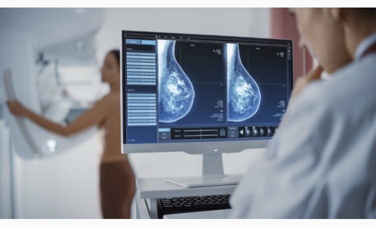 乳房X光攝影檢查，可用來偵測乳房的鈣化點或微小腫瘤