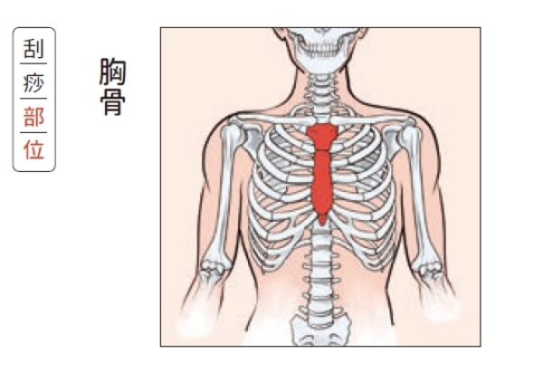 怕另一半生氣不敢亂說話,她常胸悶刮出滿滿紅痧!在家怎麼刮痧舒緩情緒、呼吸順暢?_img_2