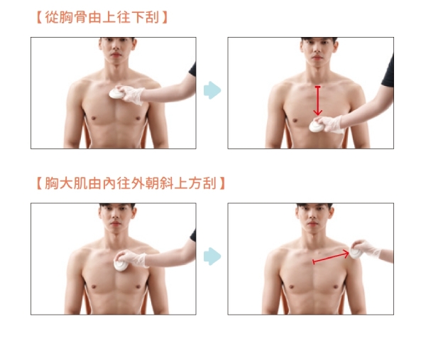 怕另一半生氣不敢亂說話，她常胸悶刮出滿滿紅痧！在家怎麼刮痧舒緩情緒、呼吸順暢？_img_3