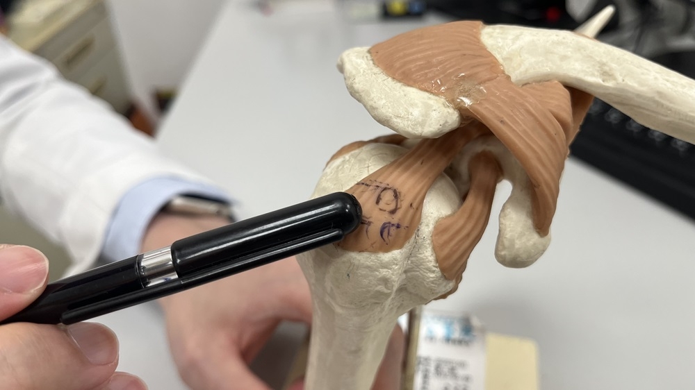 肩關節旋轉肌如果受傷，也會有類似五十肩一樣無法抬起的症狀。（出自恩主公醫院）