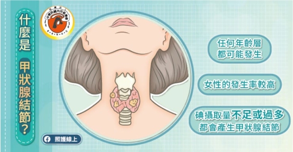 照護線上|脖子摸到突起物,甲狀腺結節有什麼症狀?有可能消失嗎?_img_1
