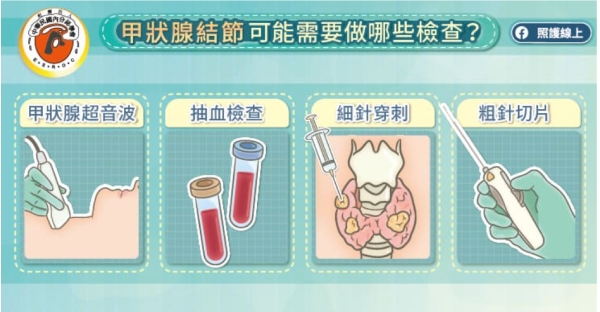 照護線上|脖子摸到突起物,甲狀腺結節有什麼症狀?有可能消失嗎?_img_2