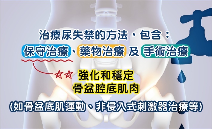 女性更年期後常見的尿失禁問題,凱格爾式運動、被動式骨盆底肌運動怎麼改善?_img_1