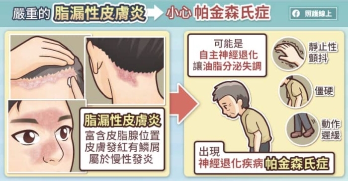 照護線上|老人斑突然增加很多,可能是腸胃道癌!5種跟重大疾病有關的皮膚病灶_img_1