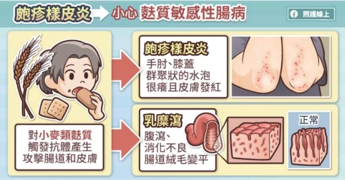 照護線上|老人斑突然增加很多,可能是腸胃道癌!5種跟重大疾病有關的皮膚病灶_img_5