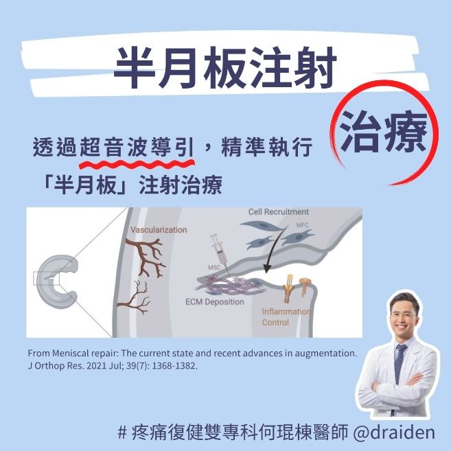 突然膝蓋痛、膝蓋腫、蹲不下去？膝蓋積水的4個症狀，如何治療趕快好？_img_4