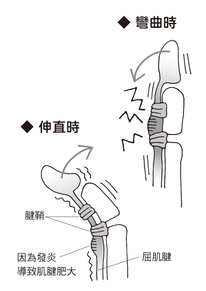 （圖片來源：《一本終結！關節痛養護大全》）
