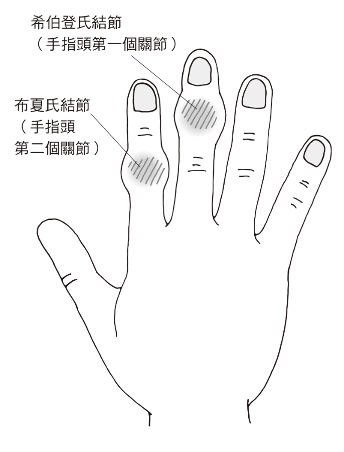 （圖片來源：《一本終結！關節痛養護大全》）