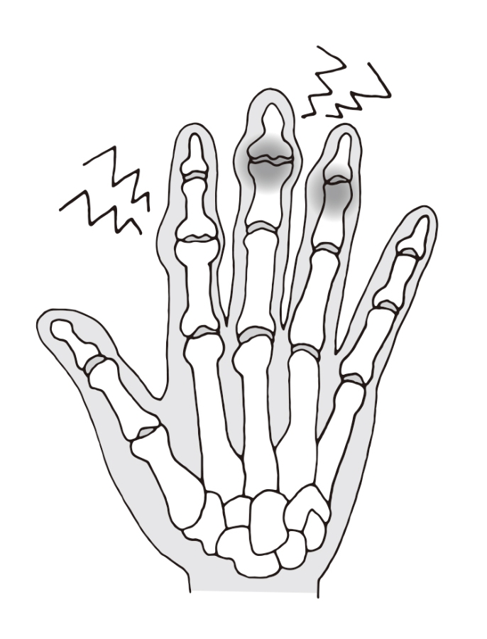 （圖片來源：《一本終結！關節痛養護大全》）