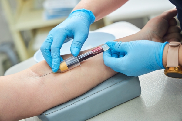 阿茲海默症的抽血檢測已具臨床研究基礎，未來有望成為簡便的早期診斷工具。